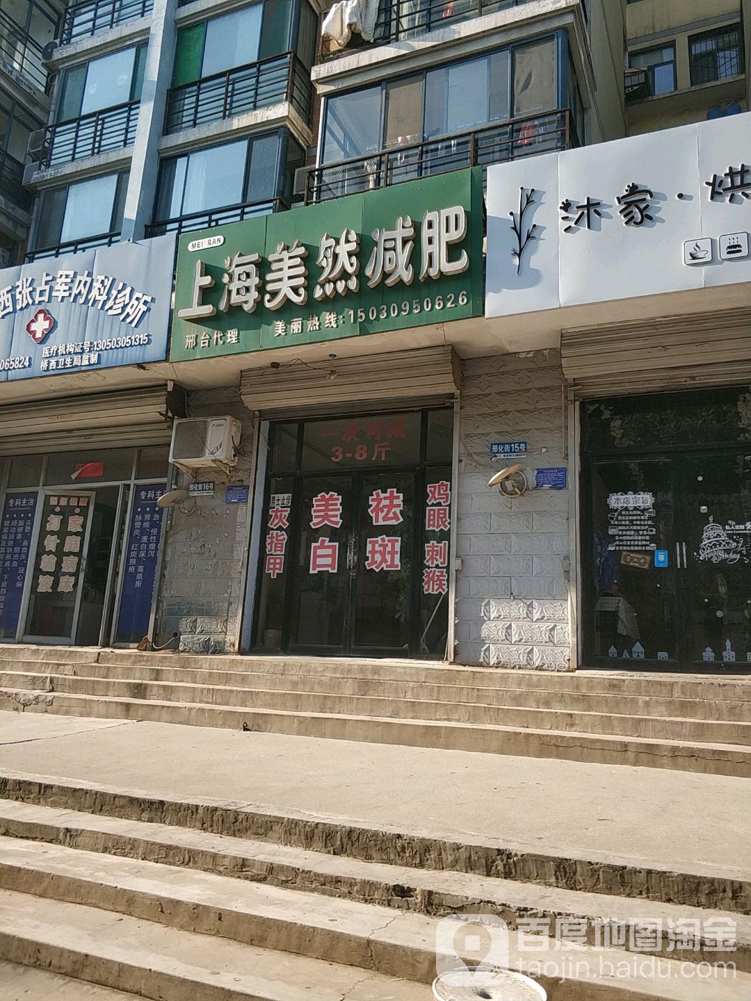 上海美然减肥