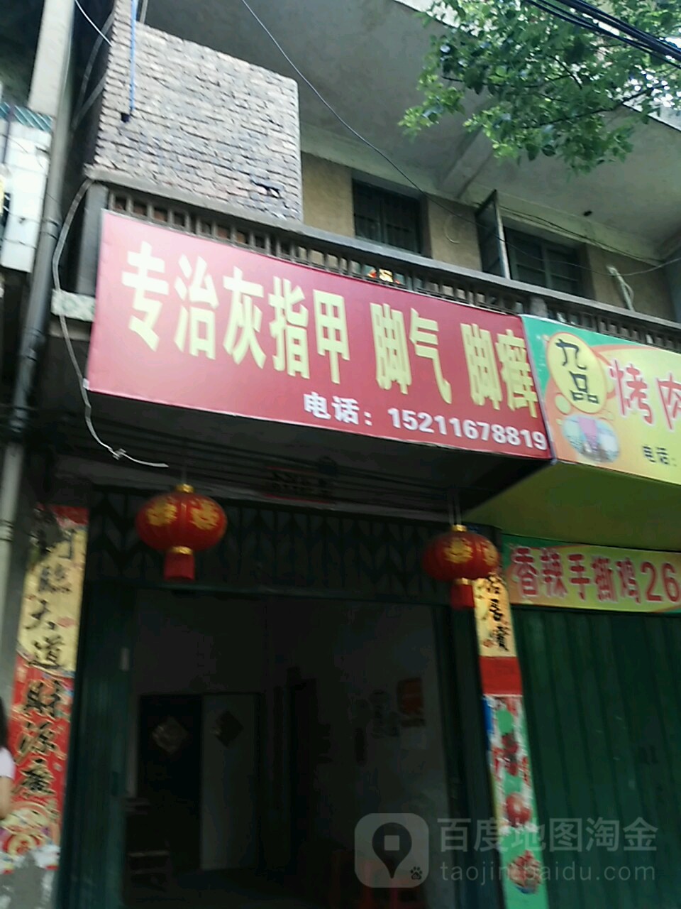 专治灰指甲脚气脚癣